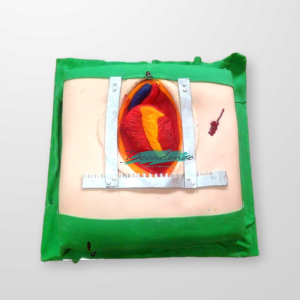 Open heart surgery themed cake